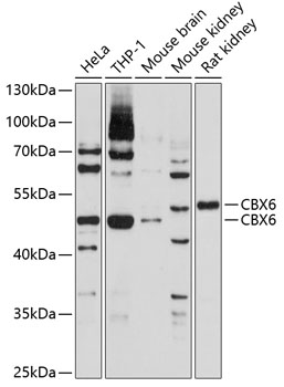 Western blot - CBX6 Polyclonal Antibody 