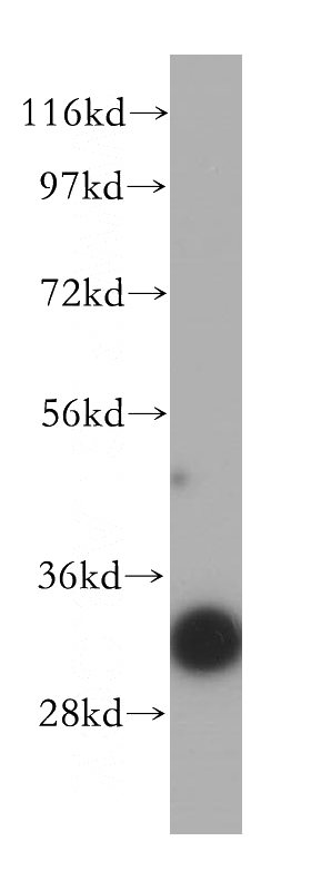 human heart tissue were subjected to SDS PAGE followed by western blot with Catalog No:116732(VDAC3 antibody) at dilution of 1:500