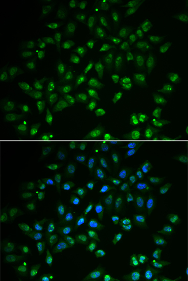 Immunofluorescence - HAND2 Polyclonal Antibody 