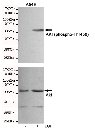 Western blot analysis of extracts from A549 cells, untreated or treated with EGF(10ng/ml,10min), using AKT (phospho-Thr450) Rabbit pAb (166704,1:500 diluted,upper) and AKT(pan) Mouse mAb (200323,lower).