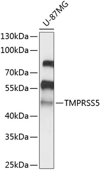 Western blot - TMPRSS5 Polyclonal Antibody 