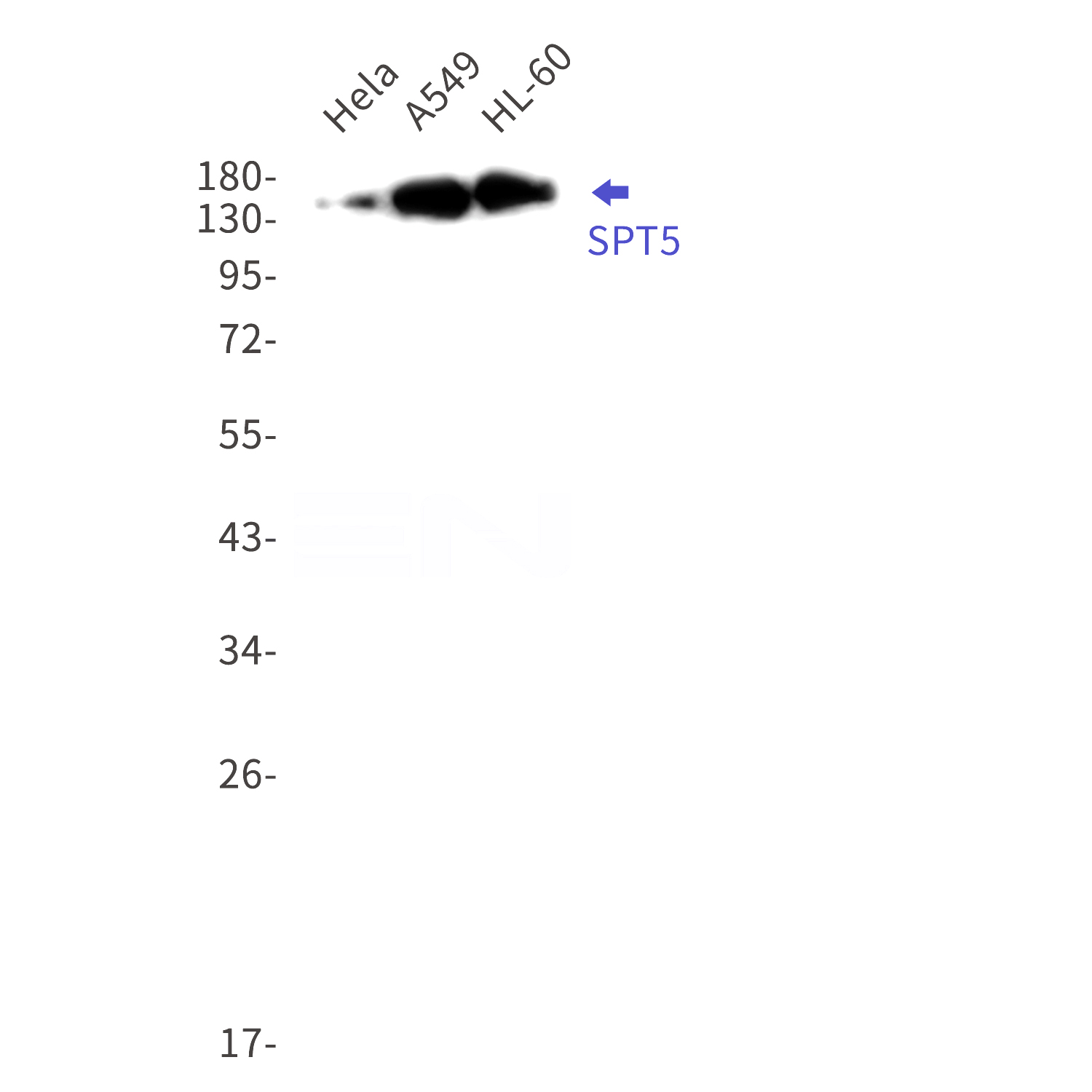 Western blot detection of  SPT5 in Hela,A549,HL-60 cell lysates using SPT5 Rabbit mAb(1:1000 diluted).Predicted band size:121kDa.Observed band size:150kDa.