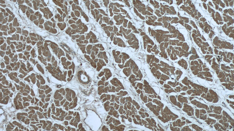Immunohistochemistry of paraffin-embedded human heart tissue slide using Catalog No:109841(DDX58 Antibody) at dilution of 1:50 (under 10x lens)