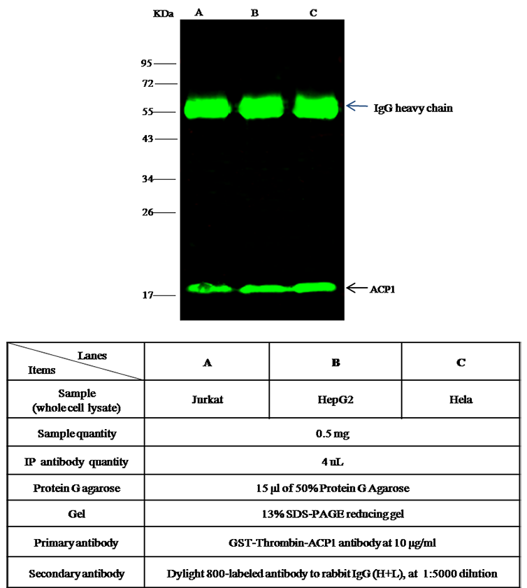 Human ACP1 / LMW-PTP Immunoprecipitation(IP) 15589