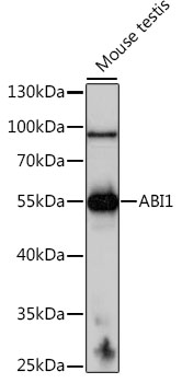 Western blot - ABI1 Polyclonal Antibody 
