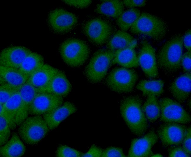 Fig3: ICC staining Transmembrane protein 200A (green) in HepG2 cells. The nuclear counter stain is DAPI (blue). Cells were fixed in paraformaldehyde, permeabilised with 0.25% Triton X100/PBS.