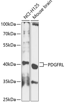 Western blot - PDGFRL Polyclonal Antibody 