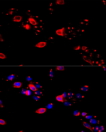 Immunofluorescence - CCT8 Polyclonal Antibody 