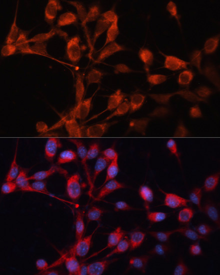 Immunofluorescence - SLC25A19 Polyclonal Antibody 