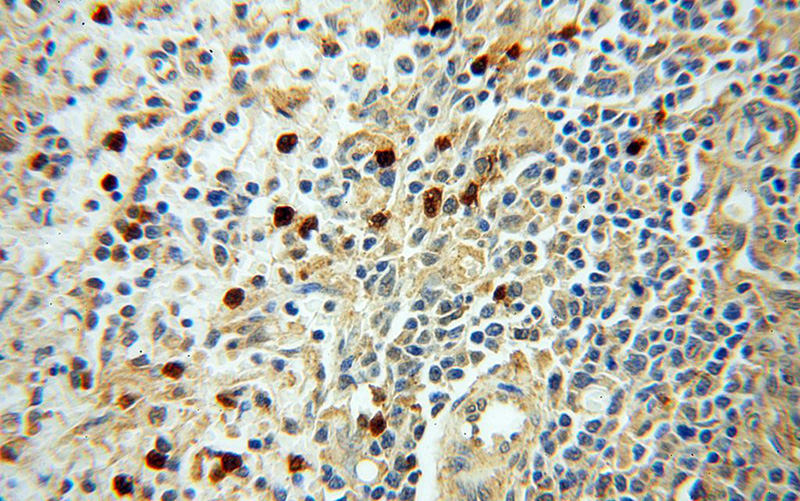 Immunohistochemical of paraffin-embedded human spleen using Catalog No:113596(PARP9 antibody) at dilution of 1:50 (under 40x lens)