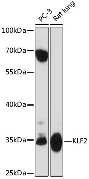 Western blot - KLF2 Polyclonal Antibody 