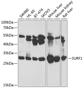 Western blot - SURF1 Polyclonal Antibody 