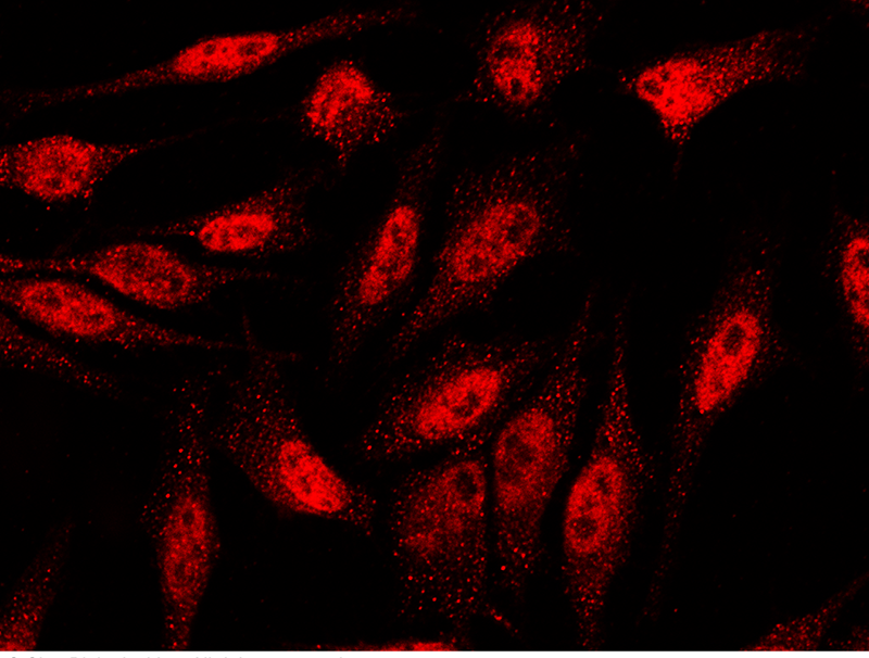 Human CAND1/TIP120A Immunofluorescence(IF) 15431