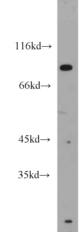 PC-3 cells were subjected to SDS PAGE followed by western blot with Catalog No:115684(STAT1 antibody) at dilution of 1:600