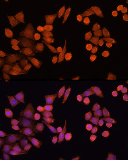 Immunofluorescence - PLA2G4D Polyclonal Antibody 