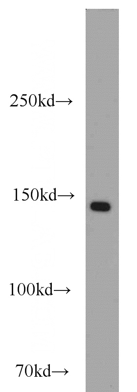 mouse pancreas tissue were subjected to SDS PAGE followed by western blot with Catalog No:109378(COL3A1 antibody) at dilution of 1:1000