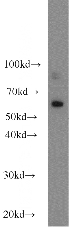 Human peripheral blood leukocyte were subjected to SDS PAGE followed by western blot with Catalog No:112111(KLRG1 antibody) at dilution of 1:200