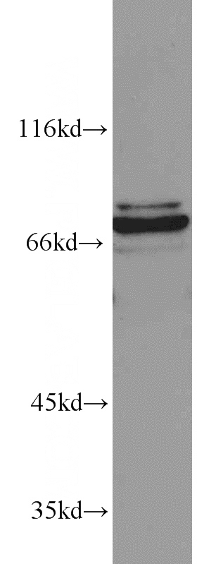 mouse brain tissue were subjected to SDS PAGE followed by western blot with Catalog No:109196(CETP antibody) at dilution of 1:600