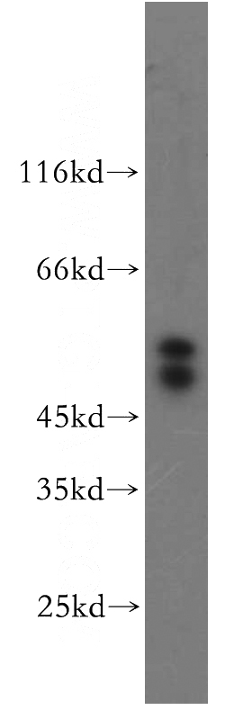A2780 cells were subjected to SDS PAGE followed by western blot with Catalog No:110784(FSTL1 antibody) at dilution of 1:300