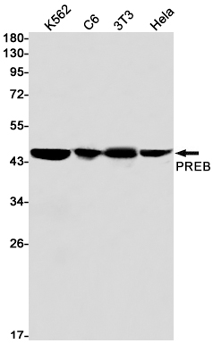 Western blot detection of PREB in K562,C6,3T3,Hela cell lysates using PREB Rabbit mAb(1:1000 diluted).Predicted band size:46kDa.Observed band size:46kDa.