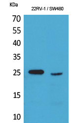 Fig1:; Western Blot analysis of 22RV-1, SW480 cells using SSX Polyclonal Antibody.. Secondary antibody（catalog#: HA1001) was diluted at 1:20000