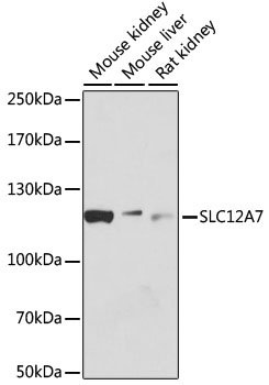 Western blot - SLC12A7 Polyclonal Antibody 