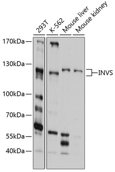 Western blot - INVS Polyclonal Antibody 