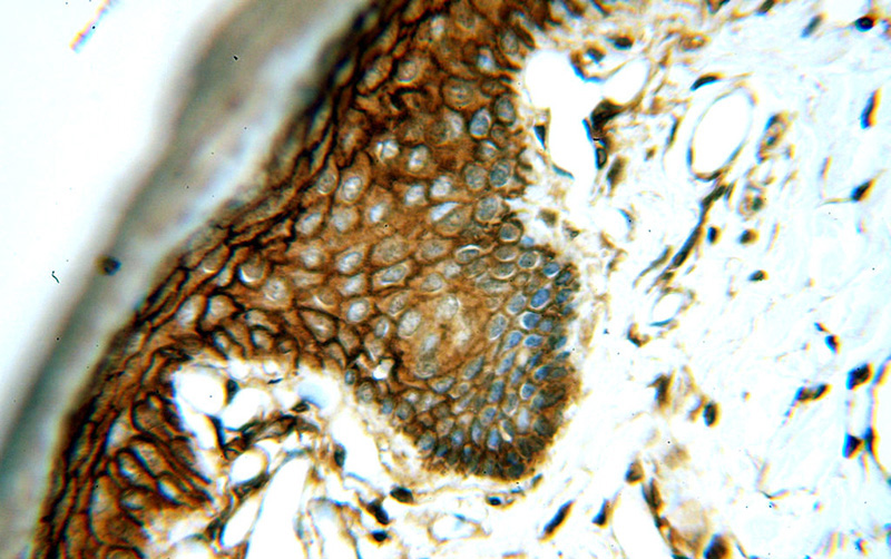 Immunohistochemical of paraffin-embedded human skin using Catalog No:110288(E-cadherin antibody) at dilution of 1:50 (under 40x lens)