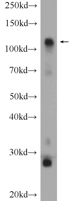 mouse heart tissue were subjected to SDS PAGE followed by western blot with Catalog No:111412(HK1 Antibody) at dilution of 1:300