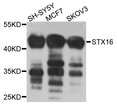Western blot - STX16 Polyclonal Antibody 