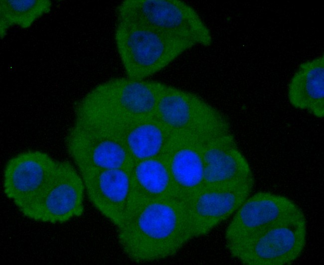 Fig2:; ICC staining of Factor H in Hela cells (green). Formalin fixed cells were permeabilized with 0.1% Triton X-100 in TBS for 10 minutes at room temperature and blocked with 1% Blocker BSA for 15 minutes at room temperature. Cells were probed with the primary antibody ( 1/50) for 1 hour at room temperature, washed with PBS. Alexa Fluor®488 Goat anti-Rabbit IgG was used as the secondary antibody at 1/1,000 dilution. The nuclear counter stain is DAPI (blue).