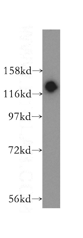 HeLa cells were subjected to SDS PAGE followed by western blot with Catalog No:113299(P130 antibody) at dilution of 1:500