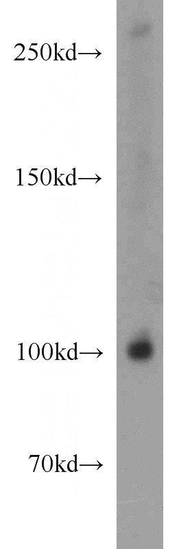 HepG2 cells were subjected to SDS PAGE followed by western blot with Catalog No:108378(BBX antibody) at dilution of 1:1500