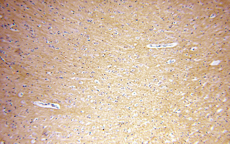 Immunohistochemical of paraffin-embedded human brain using Catalog No:114504(RAC1/2/3 antibody) at dilution of 1:100 (under 10x lens)