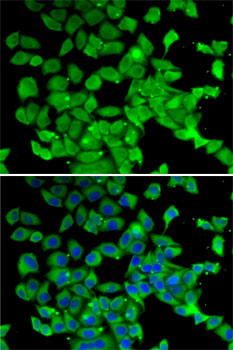 Immunofluorescence - PARN Polyclonal Antibody 