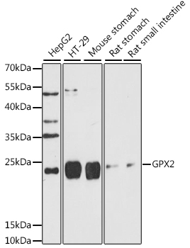 Western blot - GPX2 Polyclonal Antibody 