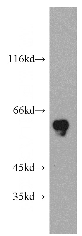 HeLa cells were subjected to SDS PAGE followed by western blot with Catalog No:108991(CCDC9 antibody) at dilution of 1:500