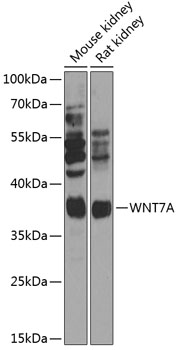 Western blot - WNT7A Polyclonal Antibody 