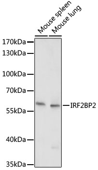 Western blot - IRF2BP2 Polyclonal Antibody 
