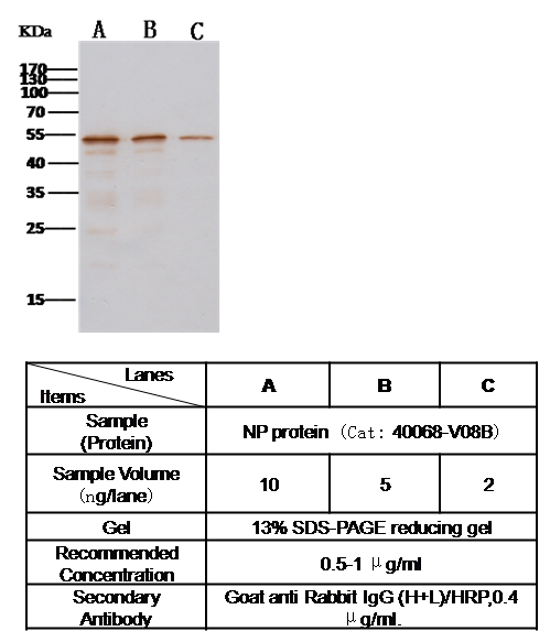 Anti-Novel coronavirus (HCoV-EMC/2012) Nucleocapsid Protein Antibody, Rabbit PAb, Antigen Affinity Purified, Western blot