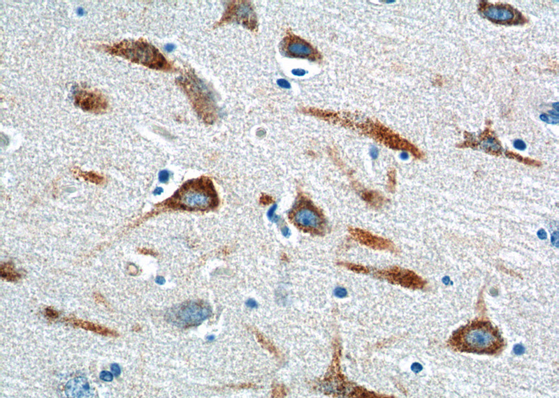 Immunohistochemistry of paraffin-embedded human brain tissue slide using Catalog No:114267(PTGER3 Antibody) at dilution of 1:200 (under 40x lens).