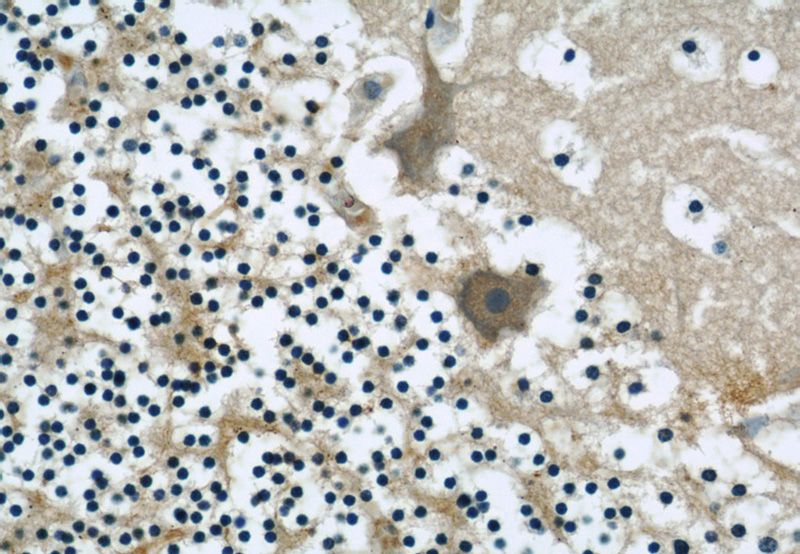 Immunohistochemical of paraffin-embedded human cerebellum using Catalog No:107327(NENF antibody) at dilution of 1:50 (under 40x lens)