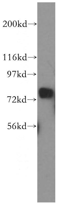 MDA-MB-453s cells were subjected to SDS PAGE followed by western blot with Catalog No:113586(PARN antibody) at dilution of 1:500