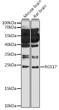 Western blot - RGS17 Polyclonal Antibody 