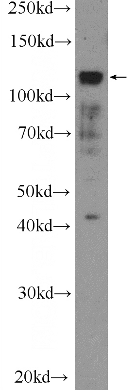 HEK-293 cells were subjected to SDS PAGE followed by western blot with Catalog No:114024(PML Antibody) at dilution of 1:300