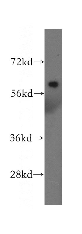 HeLa cells were subjected to SDS PAGE followed by western blot with Catalog No:108402(BACE2 antibody) at dilution of 1:500