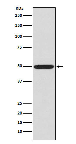 Western blot analysis of Phospho-PKA R2 (Ser99) in K562 cell lysate.
