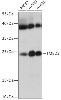 Western blot - TMED3 Polyclonal Antibody 