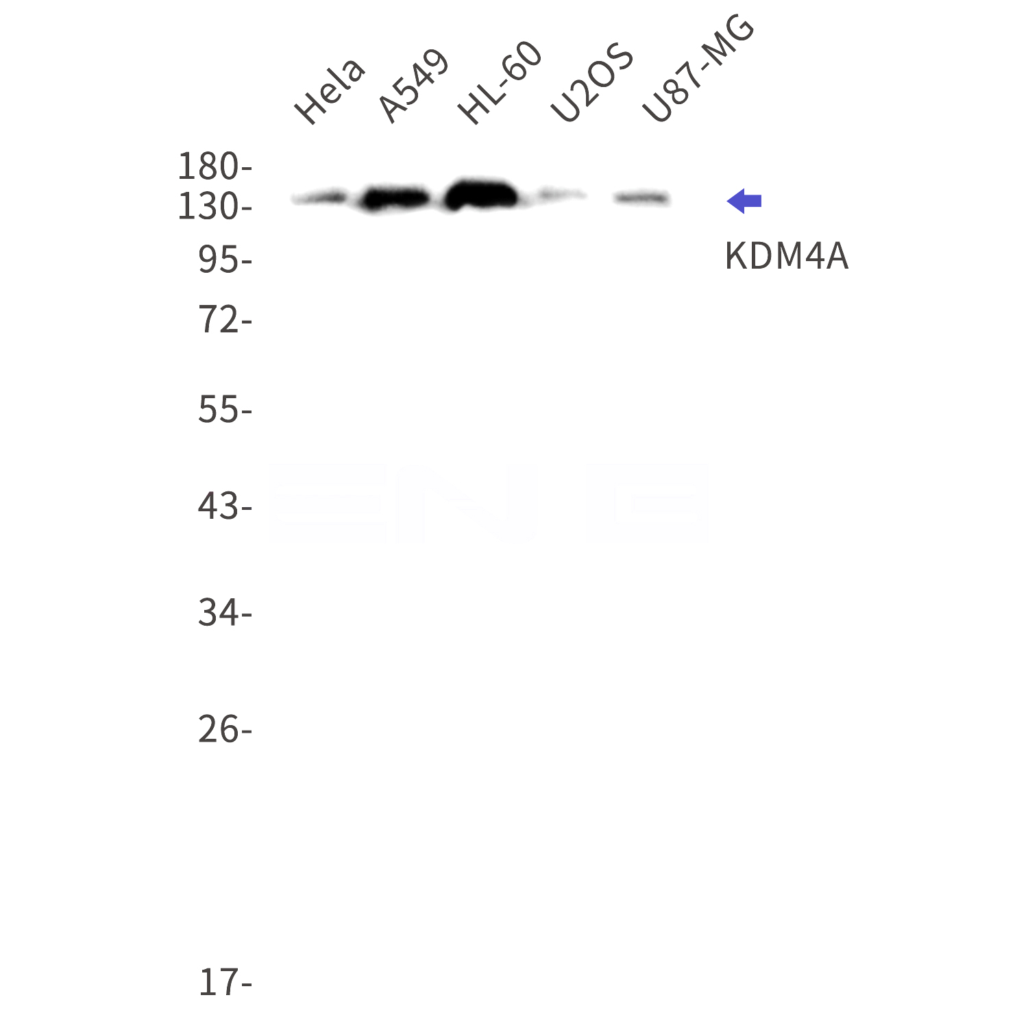 Western blot detection of KDM4A in Hela,A549,HL-60,U2OS,U87-MG cell lysates using KDM4A Rabbit mAb(1:1000 diluted).Observed band size:150kDa.