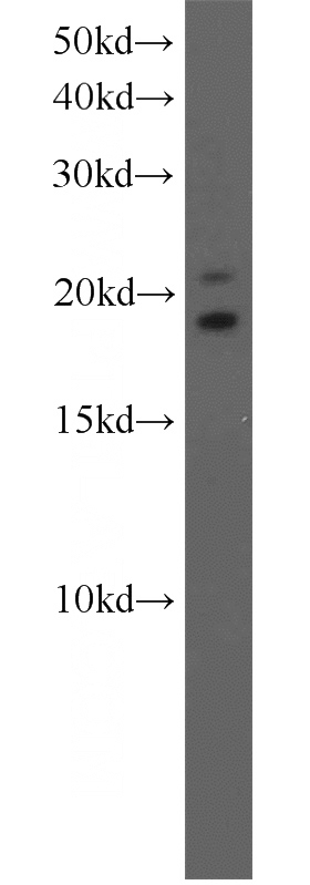 A375 cells were subjected to SDS PAGE followed by western blot with Catalog No:115542(SPANXE antibody) at dilution of 1:300